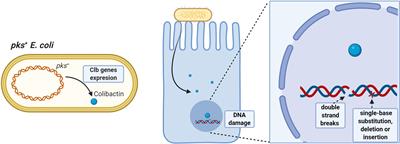 Immune System, Microbiota, and Microbial Metabolites: The Unresolved Triad in Colorectal Cancer Microenvironment